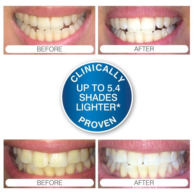 Rio USB Teeth Whitening
